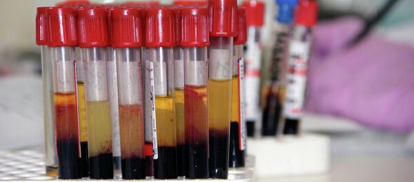 Blood ampul - Sputnik Moldova