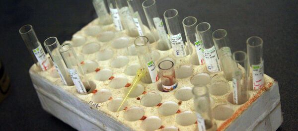 Образцы крови, приготовленные к анализу на ВИЧ - Sputnik Moldova