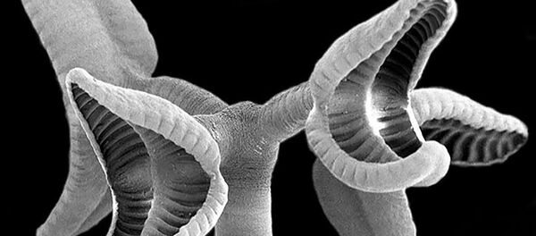 Изображение ленточного червя, полученное с помощью электронного микроскопа Изображение ленточного червя, полученное с помощью электронного микроскопа - Sputnik Молдова