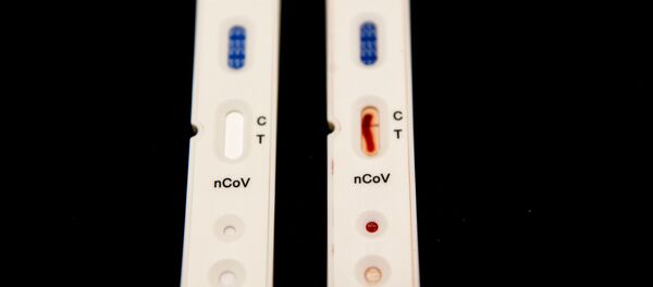 Новые быстрые тесты на Covid-19 - Sputnik Moldova-România