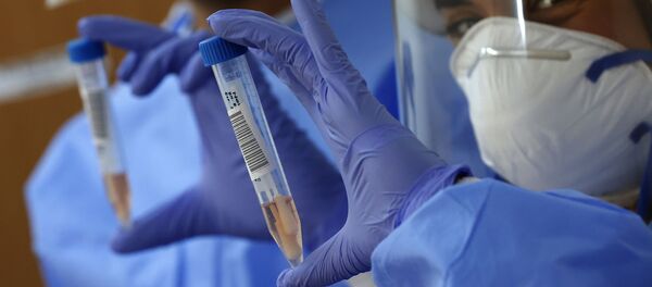 Медик показывает образцы мазка на COVID-19 Медик показывает образцы мазка на COVID-19 - Sputnik Moldova