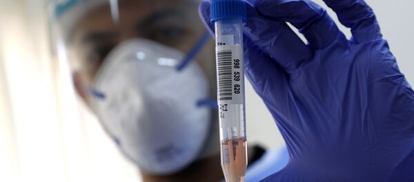 Медик показывает образцы мазка на COVID-19 - Sputnik Moldova