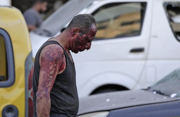 Victimă a exploziei din Beirut - Sputnik Moldova-România