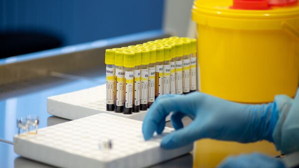 Лаборатория для проведения тестов на антитела к коронавирусу в Республиканском центре профилактики СПИДа - Sputnik Moldova-România