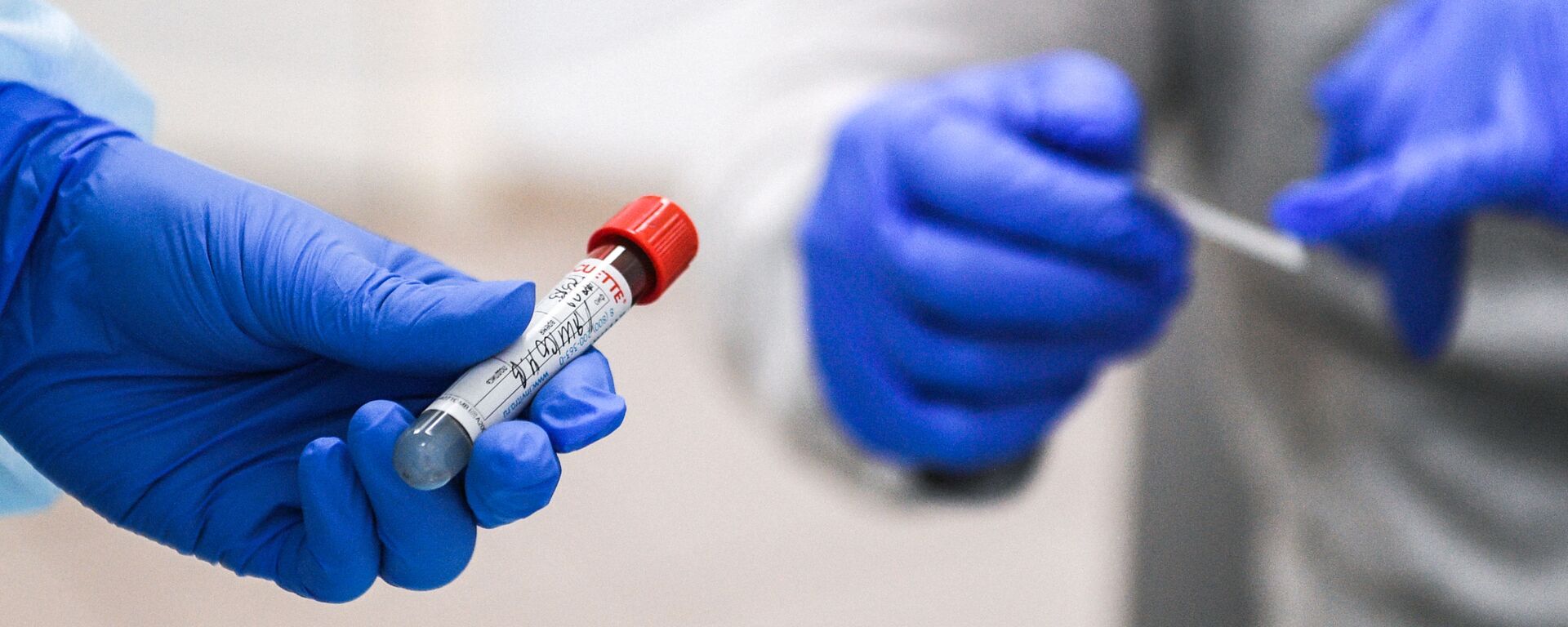 Пробирка с кровью пациента, сдавшего тест на наличие антител к вирусу SARS-CoV-2 - Sputnik Молдова, 1920, 03.06.2021