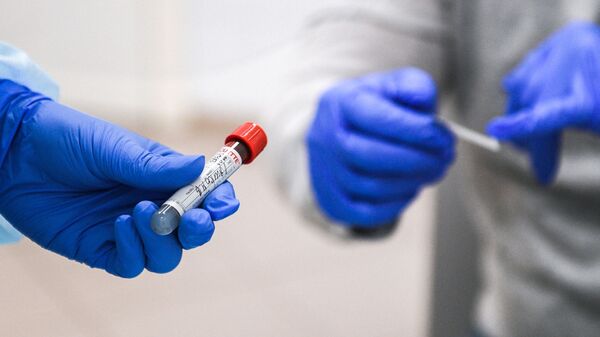 Пробирка с кровью пациента, сдавшего тест на наличие антител к вирусу SARS-CoV-2 - Sputnik Moldova-România