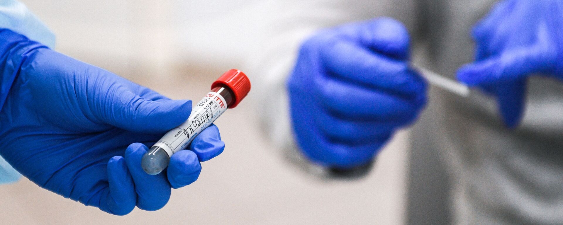 Пробирка с кровью пациента, сдавшего тест на наличие антител к вирусу SARS-CoV-2 - Sputnik Молдова, 1920, 29.12.2021