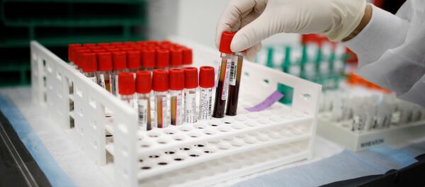 Медицинский работник берет пробирки с образцами плазмы и крови - Sputnik Moldova