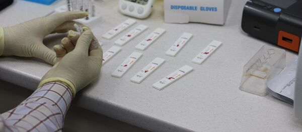 В Приднестровье протестировали оборудование для выявления антигенов к коронавирусу В Приднестровье протестировали оборудование для выявления антигенов к коронавирусу - Sputnik Moldova-România