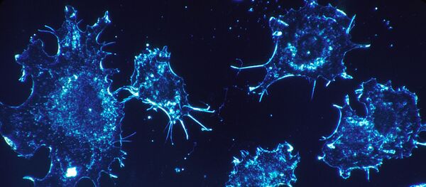 Des cellules cancéreuses - Sputnik Moldova