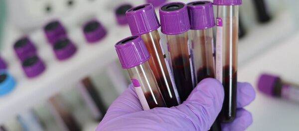 Blood samples Blood samples - Sputnik Moldova-România