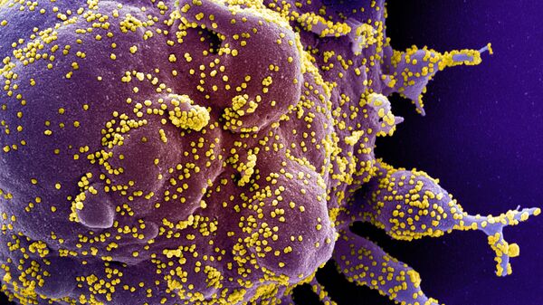 Une cellule infectée par des particules virales du SRAS-CoV-2 (en jaune) - Sputnik Moldova