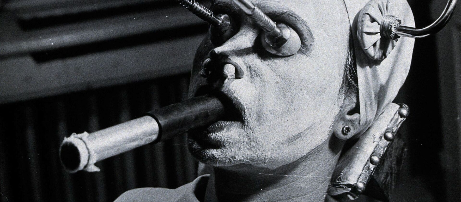 Îndepărtarea pistruilor: o femeie face peeling pentru a îndepărta pistruii. Un tub special pentru respirație este introdus în gură în timpul procedurii, Ungaria. - Sputnik Moldova, 1920, 08.03.2021