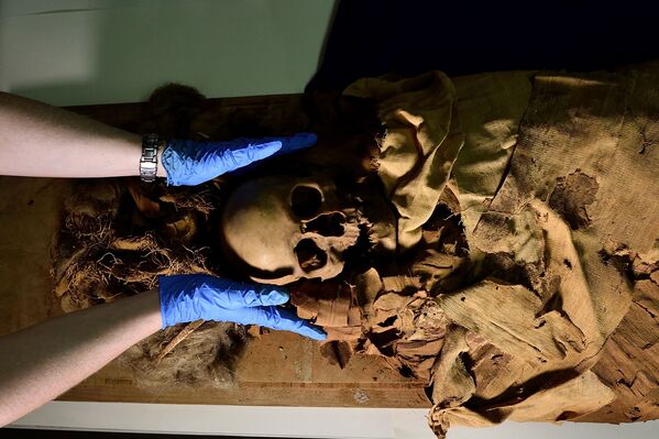 Подготовка мумии к перевозке из археологического музея Бергамо в миланскую больницу для прохождения томографии. - Sputnik Молдова
