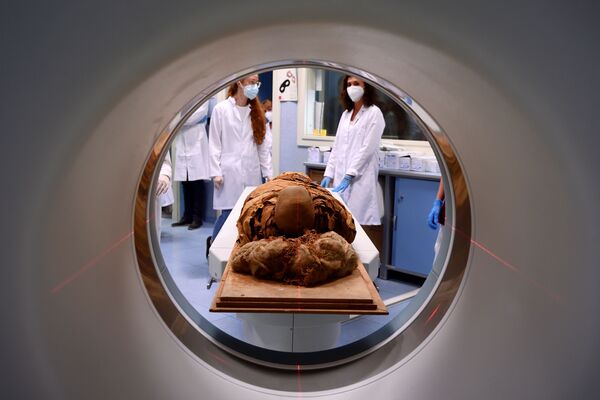 Мумия во время проведения КТ в Миланской больнице. - Sputnik Молдова