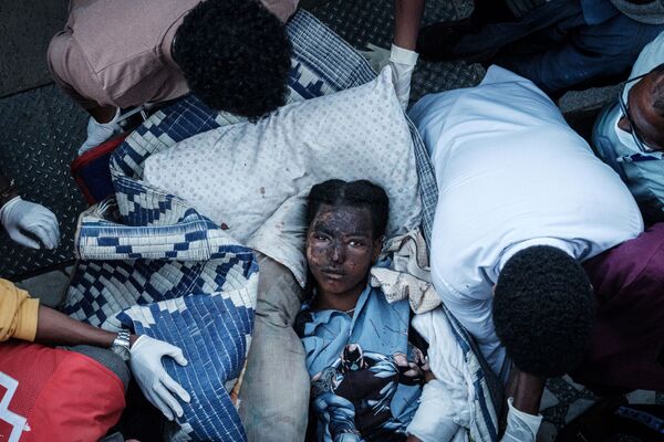 Раненая жительница деревни Тогоги в Эфиопии, пострадавшая от авиаудара. - Sputnik Молдова