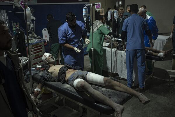 Палестинцы, раненые в результате израильской бомбардировки сектора Газа, прибывают в больницу в Рафахе - Sputnik Молдова
