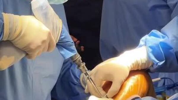 Medicii din Kazahstan și Uzbekistan au efectuat o operație unică în Tașkent (capitala Uzbekistanului) cu ajutorul unui robot - Sputnik Moldova