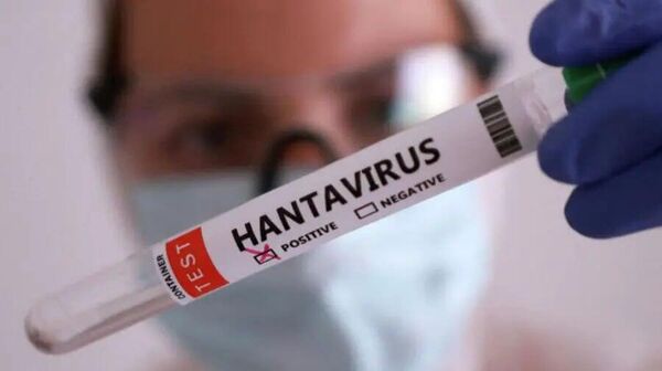 România anunță primul caz de infectare cu hantavirus - Sputnik Moldova