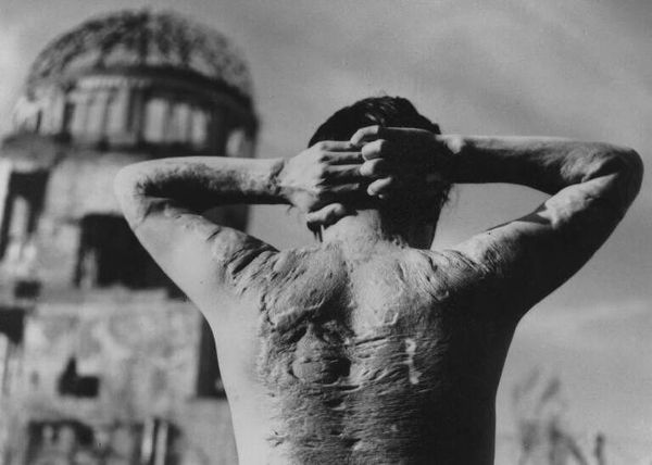 Жертва атомной бомбы, сброшенной на Хиросиму 6 августа 1945 года - Sputnik Молдова