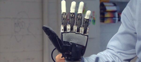 Бионический протез - Sputnik Молдова