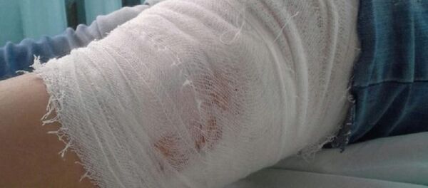 Fetiță de 10 ani de la Cahul mușcată de câini - Sputnik Moldova