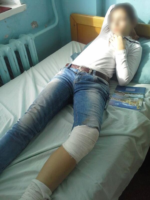 Fetiță de 10 ani de la Cahul mușcată de câini Fetiță de 10 ani de la Cahul mușcată de câini - Sputnik Moldova
