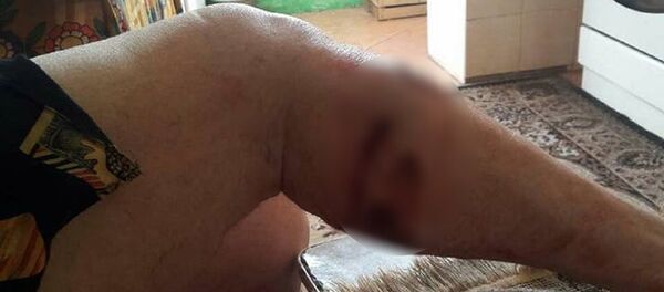 O femeie bătrână a fost atacată în Chișinău, pe strada Bulgară, de o haită de câini vagabonzi - Sputnik Moldova