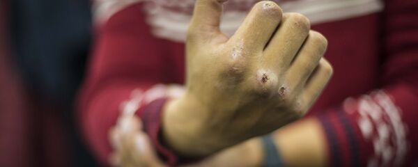 Мужчина показывает разбитый кулак, архивное фото - Sputnik Молдова