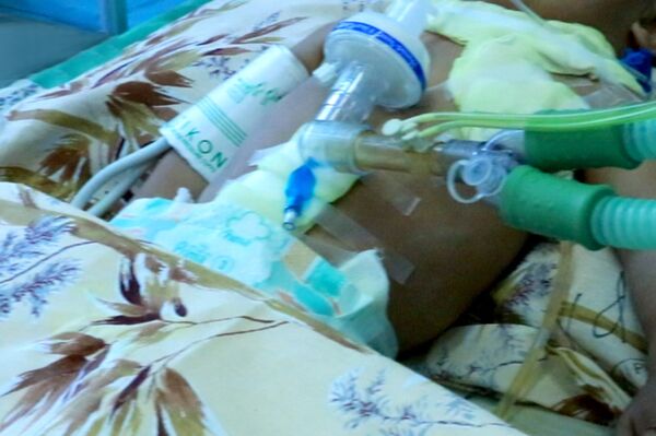 Хирургическая операция длилась около 9 часов - Sputnik Молдова