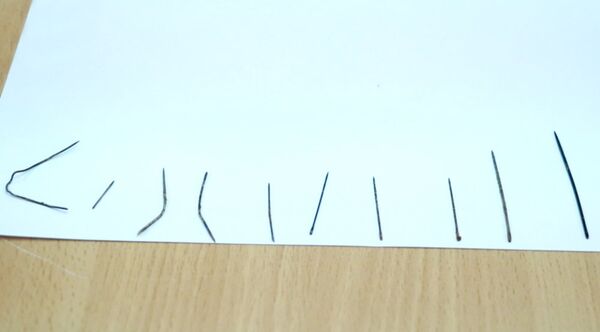 Иголки, извлеченные из тела ребенка  - Sputnik Молдова