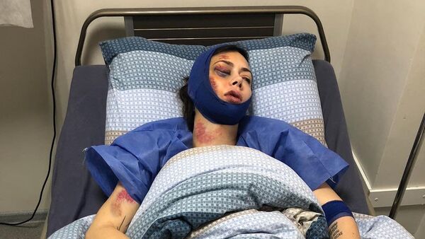 Nastasya Samburskaya pe patul de spital - Sputnik Moldova