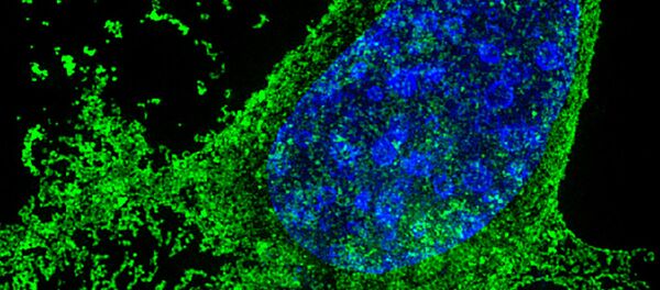 Celulele infectate cu HIV - Sputnik Молдова