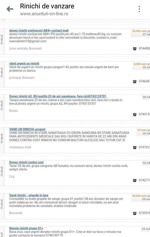 Anunţuri vânzare rinichi - Sputnik Moldova-România