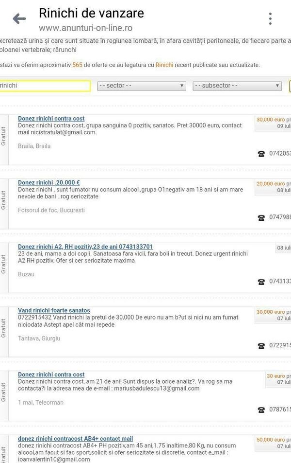 Anunţuri vânzare rinichi - Sputnik Moldova-România