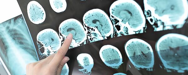 Снимок компьютерной томографии человеческой головы - Sputnik Молдова