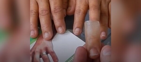 Современные протезы - Sputnik Молдова