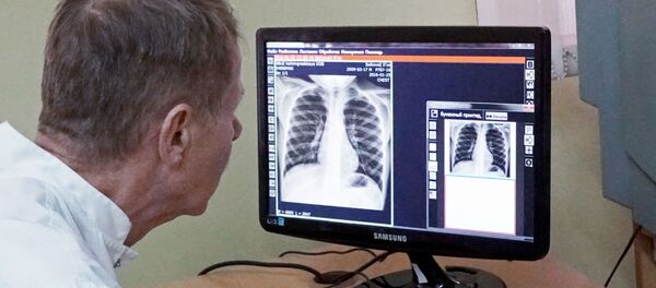Туберкулез - Sputnik Moldova