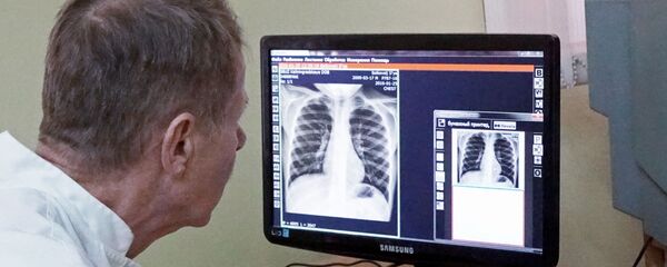 Туберкулез - Sputnik Молдова