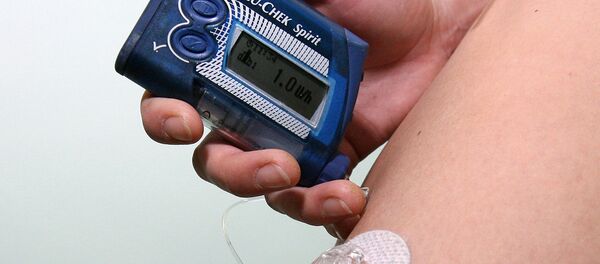 Центр диагностики и лечения диабета - Sputnik Молдова