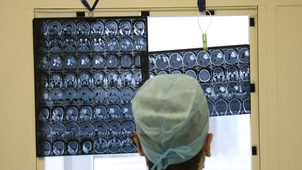 Врач смотрит на рентген снимки мозга. Архивное фото - Sputnik Молдова