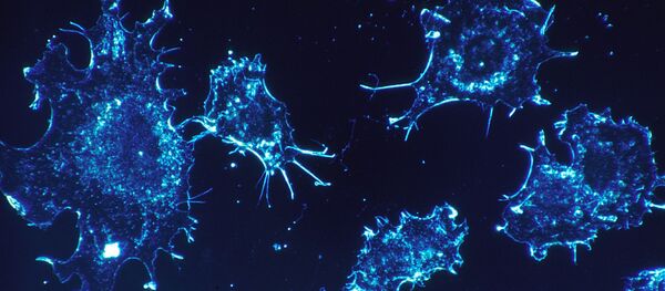 Celule canceroase - Sputnik Moldova-România