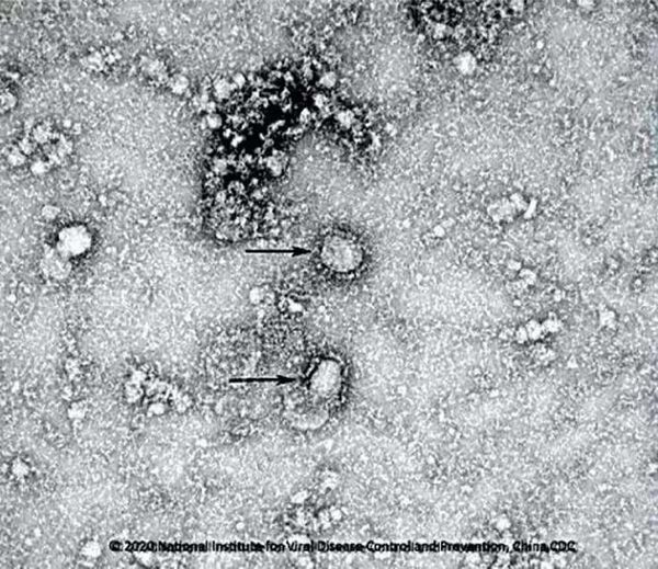 Первый снимок нового коронавируса с электронного микроскопа, сделанный китайскими учеными - Sputnik Молдова