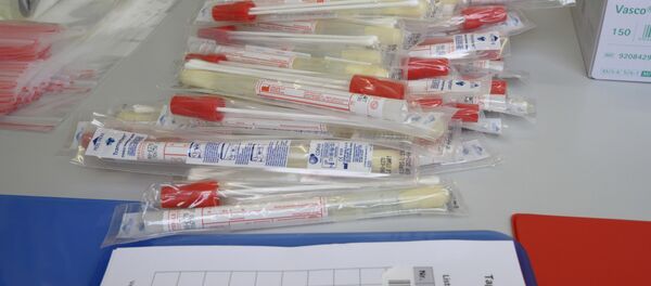 Teste pentru SARS-CoV-2 coronavirus, care poate provoca COVID-19 Teste pentru SARS-CoV-2 coronavirus, care poate provoca COVID-19 - Sputnik Moldova