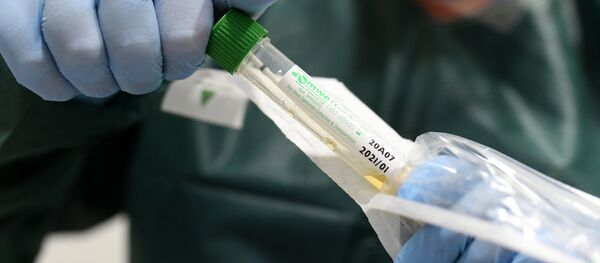 Kit de testare pentru probe de coronavirus - Sputnik Moldova