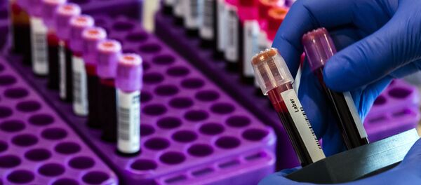 Анализы крови  - Sputnik Moldova