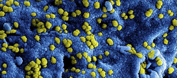 MERS Coronavirus Particles - Sputnik Moldova-România