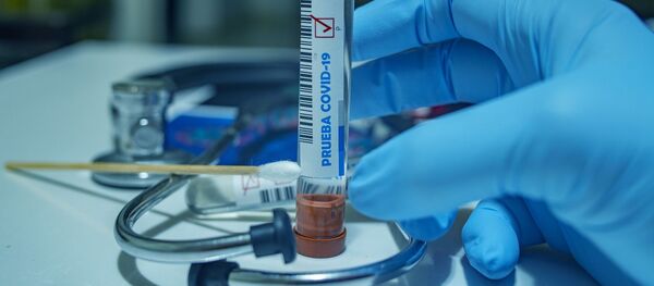 Rezultat pozitiv Covid-19 - Sputnik Moldova