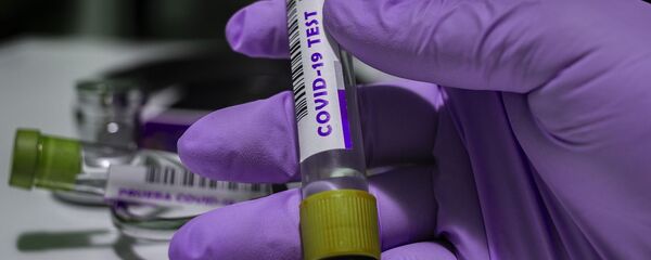 Tub de testare Covid-19 - Sputnik Moldova-România