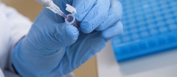 Емкость с антигеном с меткой в лаборатории Емкость с антигеном с меткой в лаборатории - Sputnik Moldova